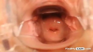 Pussy Close Up And Speculum