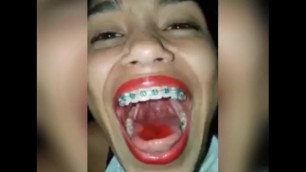 Latina uvula 1